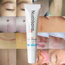 Nuobisong-crema hidratante antienvejecimiento para eliminar cicatrices, Corrector de pigmentación, elimina las estrías del acné, 5 uds. 2024 - compra barato