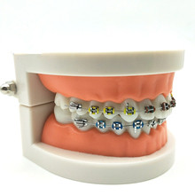 Стоматологическая Ортодонтическая модель для лечения, 1 шт., металлический керамический кронштейн 2024 - купить недорого