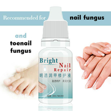 Firstsun-Gel brillante para reparación de uñas, tratamiento para el cuidado, eliminación de hongos en las uñas de los pies, antiinfección, paroniquia, onicomicosis, TSLM1 2024 - compra barato
