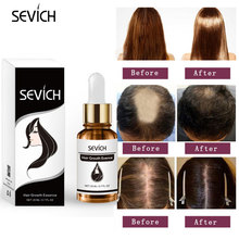 Эфирное масло для роста волос Sevich Care, оригинал, 100% защита от выпадения волос, сыворотка для восстановления волос, быстрее, 20 мл 2024 - купить недорого