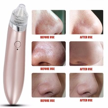 Electric Facial Blackhead Remove Machine Vacuum Acne Cleaner Pore Remover Electric Skin Facial Cleanser Care Pore Peeling Tool 2024 - buy cheap