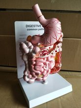 Human gastrointestinal pathology model doctor-patient communication demonstration model digestive system disease teaching model 2024 - buy cheap