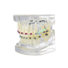 Modelo de dente transparente, oclusão ortodôntica colorida, modelo para estudo dental, ensino de dentista, 1 peça 2024 - compre barato