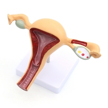 Modelo de anatomia genital feminina útero geniturinário do ovário modelo de ensino médico 2024 - compre barato