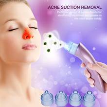 Blackhead Remover Vacuum Acne Removal Pore Vacuum Face Deep Nose Cleaner Care Suction Cleanser Vacuum Cleaning Tool 2024 - buy cheap