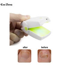 Toenail Fungus Treatment Laser Therapy Device Toenails Nails And Hand Nails Anti Fungal Onychomycosis Treatment No Pain Home Use 2024 - buy cheap