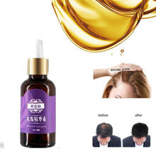 Aceite Esencial de jengibre para el crecimiento rápido del cabello, suero líquido para evitar pérdida de cabello, reparación de cabello dañado, triangulación de envíos 2024 - compra barato