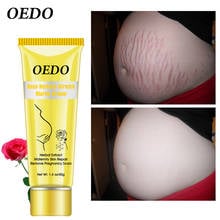OEDO Scar Removal Cream Rose Remove Stretch Mark Cream Nourish Pregnant Women Skin Repair Remove Obesity Tattoo Body Care 2024 - buy cheap
