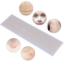 1pc Silicone Scar Removal Patch Remove Trauma Burn Scar Sheet Skin Repair Scar Removal Therapy Patch For Acne Scar Treatment 2024 - купить недорого