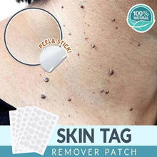 36pcs Skin Tag Remover Warts Remover Patch Wart Treatment Cream Herbal Extract Foot Corn Plaster Acne Warts Ointment 2024 - купить недорого