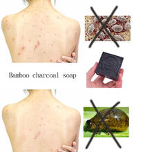 100g Bamboo Charcoal Soap Anti-mites Anti-acne Body Cleansing Soap Skin Treatment Acne Psoriasis Seborrhea Eczema Anti Fungus 2024 - buy cheap