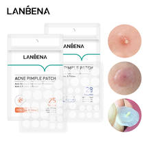 LANBENA Acne Pimple Patch  Invisible Acne Stickers Blemish Treatment Acne Master Pimple Remover Beauty Tool Skin Care 2024 - купить недорого