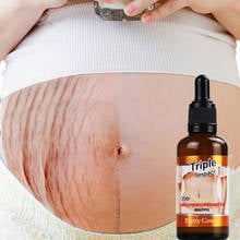 50ML Stretch Marks Remover Essential Oil Skin Care Treatment Cream For Stretch Mark Maternity Slackline For Pregnant Oils 2024 - buy cheap