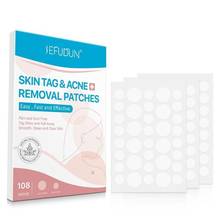 Adesivo de remoção de acne para pele, adesivo invisível para cuidados com a pele, acne, removedor de marcas 2024 - compre barato