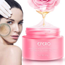 EFERO Remove Freckle Cream Skin Whitening Cream Remove Melasma Acne Spots Pigment Melanin Dark Spots Moisturizing Face Cream 2024 - buy cheap