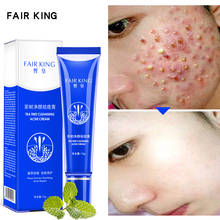 Hot 15ML Acne Treatment Blackhead Remova Anti Acne Cream Oil Control Shrink Pores Acne Scar Remove Face Care Whitening 2024 - buy cheap