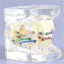 Dental Orthodontic Tooth Model M3005/Dental Othodontic Study Teeth Model for Fault Correction Doctor-patient Communication Model 2024 - buy cheap