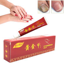 Tratamento de unhas antifúngicas/onicomicose, paroníquia/infecção de unhas das unhas das mãos e dos pés, tratamento herbal chinês 2024 - compre barato