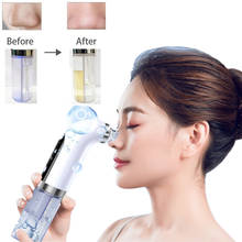 Electric Blackhead Remover Pore Vacuum Suction Facial Cleaner Rechargeable Water Cycle Pimple Removal Acne Extractor Tool 2024 - buy cheap