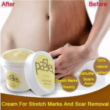 Genuine Thailand Skin Body Cream Remove Stretch Marks Treatment Postpartum Repair Whitening CREAM Pregnancy Scar Removal 50g 2024 - buy cheap