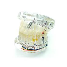Стоматологическая модель зубного стоматолога Патология модель ремонта с нервными зубами обучающая модель 2024 - купить недорого