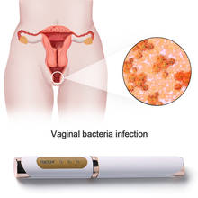 Vaginal Tightening gynecology vaginitis cervical erosion birth canal rehabilitation Dry and relaxation vaginal Postpone menopaus 2024 - buy cheap