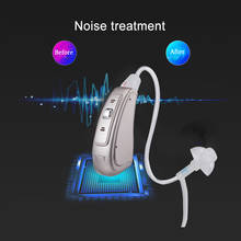 Усилитель слухового аппарата для ушей, усилитель звука с цифровым чипом и встроенным аккумулятором A312, подарок для пожилых людей, MY-20 2024 - купить недорого