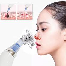 Blackhead Remover Face Deep Cleaner Pore Acne Pimple Removal Vacuum Suction Facial Diamond Beauty Clean Skin Care SPA Tool 2024 - buy cheap