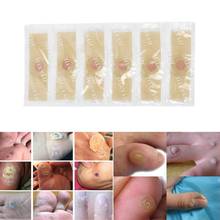Foot Care Stickers Medical Plaster Chicken Eye Corns Patches Medical Plaster Foot Corn Removal 2024 - buy cheap