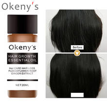 Okeny's 20ml Hair Growth Essence Fast Powerful Hair Care Essential Oil Liquid Treatment Preventing Hair Loss Products 2024 - buy cheap