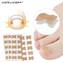 KOTLIKOFF 10PCS Ingrown Toenail Corrector Stickers Paronychia Treatment Recover Corrector Pedicure Tool Fingernail Toe Nail Care 2024 - buy cheap