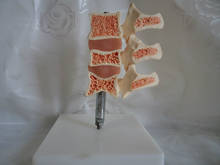 Human anatomical spine Bone vegetable pine model Spinal typical lesion model skeleton toy 2024 - buy cheap