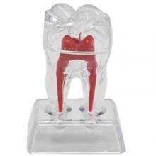 Large Tooth Molar Model Separable Teaching Demonstration Model Transparent Dentistry Material  Lab Teeth Model 2024 - buy cheap