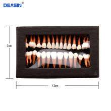 Dental oral 28 peças, modelos de dentes permanentes para adulto, presente total do mês, comunicação dental, modelos de odontologia 2024 - compre barato