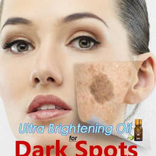 Ultra Brightening Spotless Oil Skin Care Dark Spots Remove Ance Burn Strentch Marks Scar Removal lavender Essence 2024 - buy cheap