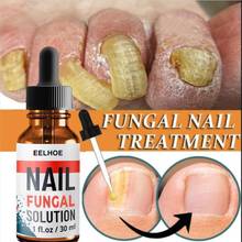 10/20/30ML Foot Anti-fungal Nail Repair Liquid Remove Anti Onychomycosis Feet Nail Care Treatment Nail Repair Liquid TSLM1 2024 - buy cheap