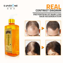 300ml Professional Hair Ginger Shampoo for Hair Growth Hair Regrowth Dense Fast Thicker Shampoo Anti Hair Loss Dandruff Product 2024 - buy cheap