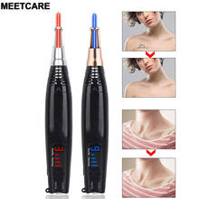 Freckle Tattoo Removal Picosecond Pen Skin Laser Mole Scar Removal Dark Spot Remover Pen Acne Skin Pigment Remover Machin 2024 - buy cheap