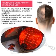 Hair Growth laser Cap Light Chips COZING Hair Loss Hair Growth Cap Hair Loss Therapy Decive Hair Regrowth Treatment Machine Hat 2024 - buy cheap