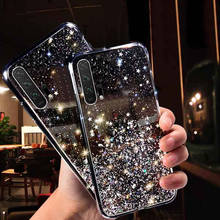 Luxo Brilho Caso Estrela Para Samsung Galaxy A91 A81 A71 A51 Caso J4 J6 Plus S8 S9 S10 Lite S20 Ultra M30 M20 M10 Capa de Silicone 2024 - compre barato