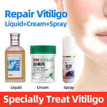 Vitiligo антибактериальное средство для лечения заболеваний лейкоплакии спины и талии жидкость для улучшения кожи меланин восстанавливающая мазь 2024 - купить недорого