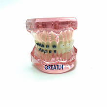 Modelo ortodôntico dentário com suporte de metal e cerâmica 3003 modelo de estudante escola dental rosa para estudantes modelo de estudo 2024 - compre barato