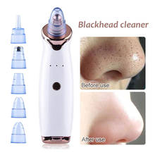 Blackhead Remover Vacuum Face Deep Clean Skin Care Machine Pore Cleaner Acne Pimple Removal Vacuum Suction Tool Dermabrasion 2024 - buy cheap