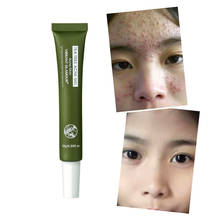Tea Tree Acne Treatment Gel 25g Effective Remove Acne Spot Pigment Melanin Dark Spots Pigmentation Moisturizing Gel Skin Care 2024 - buy cheap