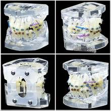 1Pc Dental Orthodontic Study Teach Teeth Model with Metal Brackets Brace 2024 - buy cheap