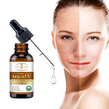 Multi Function Face Serum Argan Oil Anti Freckle Anti Wrinkle Moisturizing Removeal scars Whiten Brighten Skin Care Essence 30ml 2024 - купить недорого