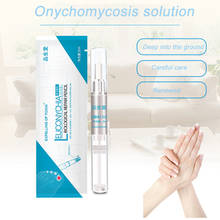 3ML Fungal Nail Treatment Pen Onychomycosis Paronychia Anti Fungal Nail Care Solution Feet Care Chinese Herbal TSLM1 2024 - buy cheap