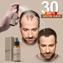 2019 Fast Hair Growth Spray for Men Herbal Hair Growth Accelerator Hair Treatment 30ml 2024 - купить недорого