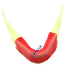 Modelo de mandíbula Mandibular Dental con implante de silicona, modelo M2027 para práctica de sutura de implante de inciensión 2024 - compra barato
