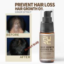 Масло для быстрого роста волос, средство для лечения выпадения волос, средство для ухода за волосами, 20 мл, B8C8 2024 - купить недорого